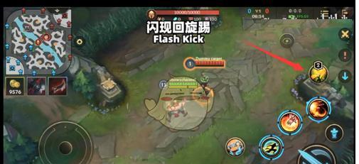 英雄联盟手游插眼技巧（提升游戏战略的必备技能）